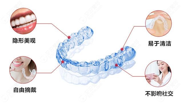 无托槽隐形牙齿矫正