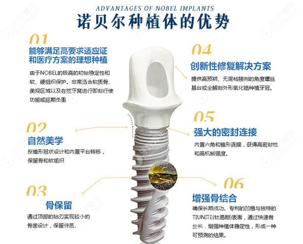 瑞典诺贝尔ACTIVE种植体